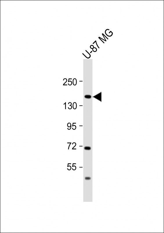 Anti-ADAMTS20 Antibody (Center) at 1:2000 dilution + U-87 MG whole cell lysateLysates/proteins at 20 �g per lane. SecondaryGoat Anti-Rabbit IgG,  (H+L), Peroxidase conjugated at 1/10000 dilution. Predicted band size : 170 kDaBlocking/Dilution buffer: 5% NFDM/TBST.