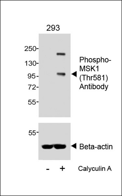 Western blot analysis of lysates from 293 cell line, untreated or treated with Calyculin A, 100nM, 30min, using Phospho-MSK1 (Thr581) Antibody (upper) or Beta-actin (lower).
