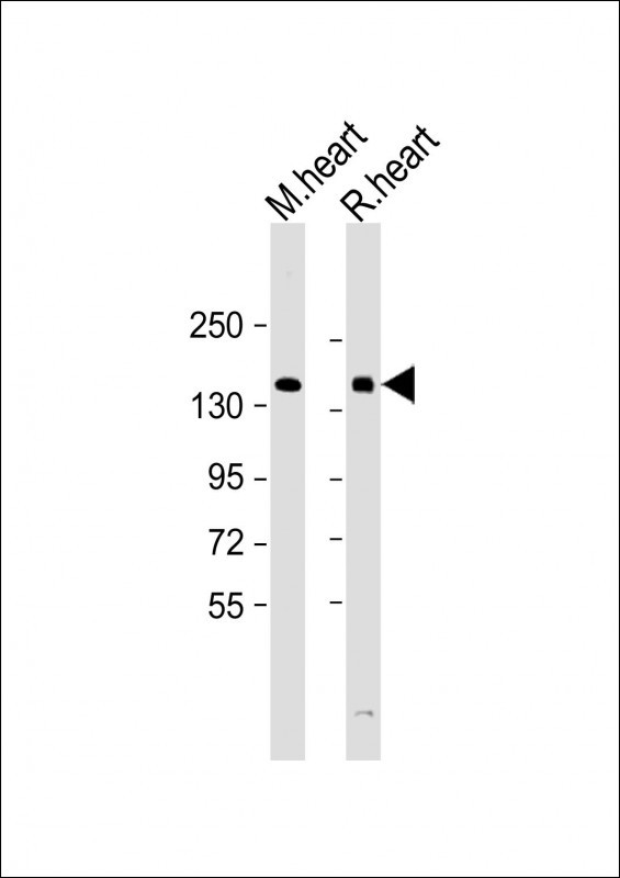 WB - HIPK3 Antibody (C-term) AP7540B