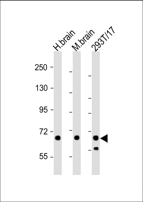WB - GLS Antibody (C-term) AP8809B