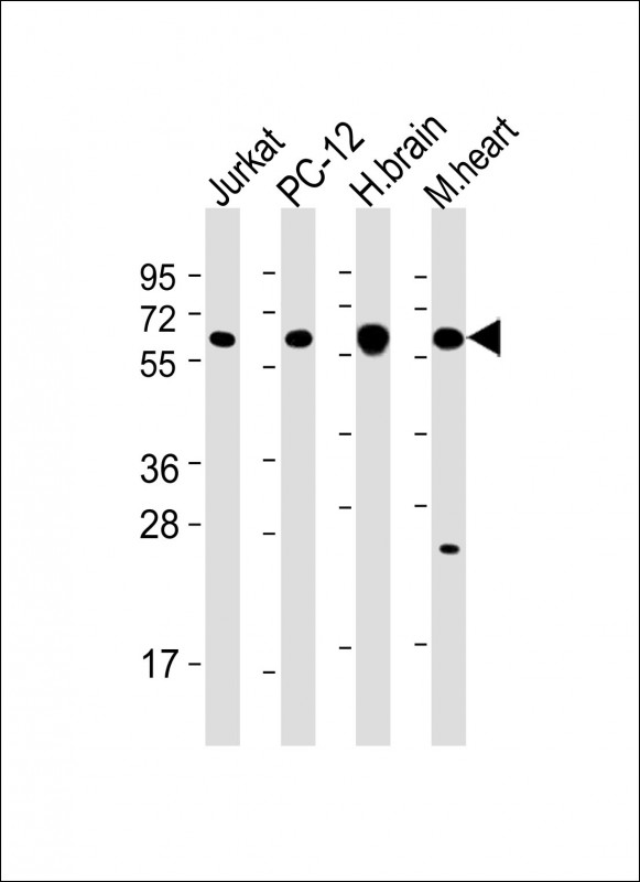 All lanes : Anti-CAMK2 beta Antibody (C-term) at 1:2000 dilutionLane 1: Jurkat whole cell lysateLane 2: PC-12 whole cell lysateLane 3: human brain lysateLane 4: mouse heart lysateLysates/proteins at 20 �g per lane. SecondaryGoat Anti-mouse IgG,  (H+L), Peroxidase conjugated at 1/10000 dilution. Predicted band size : 60 kDaBlocking/Dilution buffer: 5% NFDM/TBST.