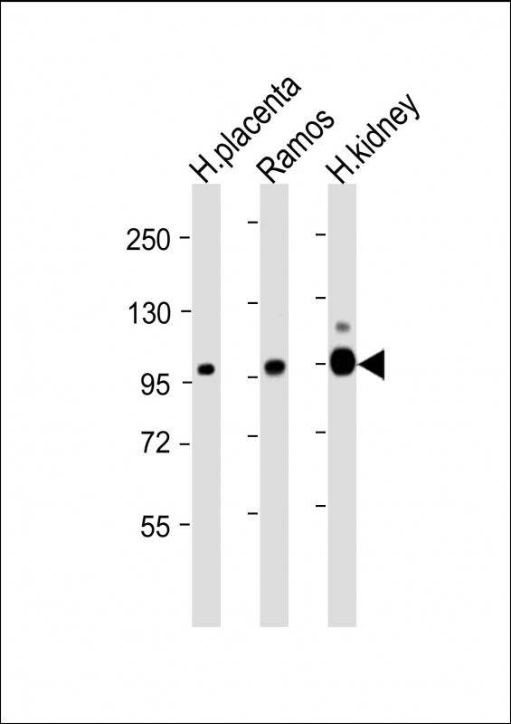 All lanes : Anti-MME Antibody (Center) at 1:4000 dilutionLane 1: Human placenta lysateLane 2: Ramos whole cell lysateLane 3: Human kidney lysateLysates/proteins at 20 �g per lane. SecondaryGoat Anti-mouse IgG,  (H+L), Peroxidase conjugated at 1/10000 dilution. Predicted band size : 100 kDaBlocking/Dilution buffer: 5% NFDM/TBST.