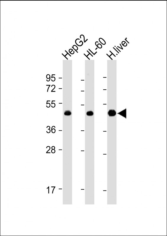 All lanes : Anti-ADK Antibody (N-term) at 1:4000 dilutionLane 1: HepG2 whole cell lysateLane 2: HL-60 whole cell lysateLane 3: Human liver lysateLysates/proteins at 20 �g per lane. SecondaryGoat Anti-mouse IgG,  (H+L), Peroxidase conjugated at 1/10000 dilution. Predicted band size : 45 kDaBlocking/Dilution buffer: 5% NFDM/TBST.