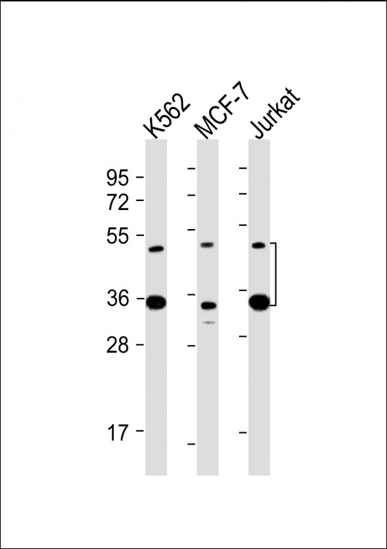 All lanes : Anti-MBD2 Antibody at 1:2000 dilutionLane 1: K562 whole cell lysateLane 2: MCF-7 whole cell lysateLane 3: Jurkat whole cell lysateLysates/proteins at 20 �g per lane. SecondaryGoat Anti-mouse IgG,  (H+L), Peroxidase conjugated at 1/10000 dilution. Predicted band size : 43 kDaBlocking/Dilution buffer: 5% NFDM/TBST.