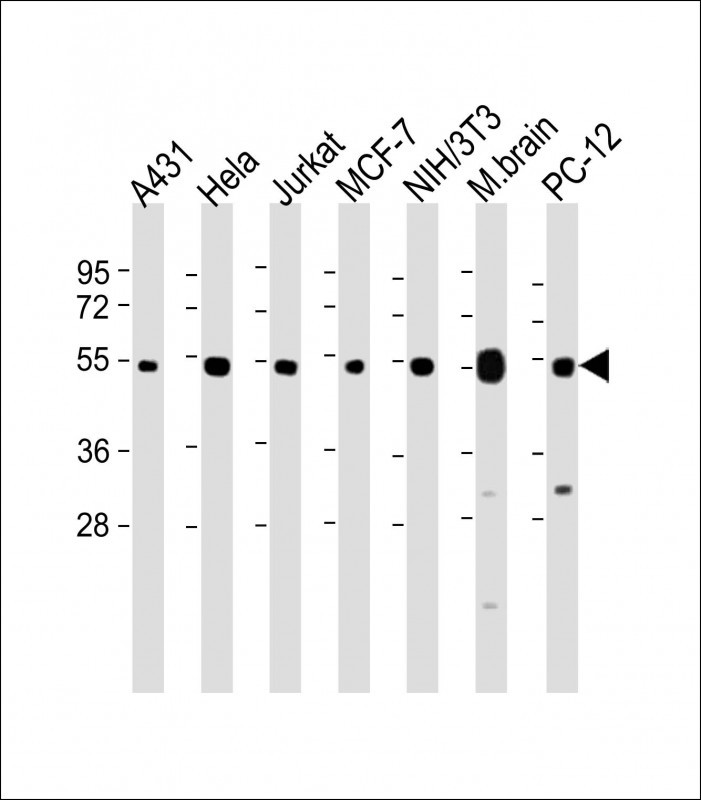 WB - TUBA4A Antibody (C-term) AP13535b