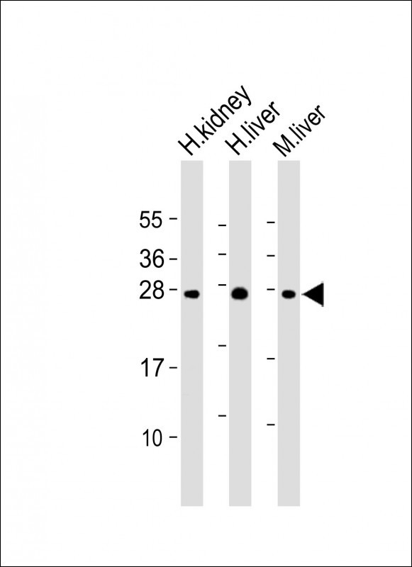 All lanes : Anti-Erythropoietin Antibody (N-term) at 1:2000 dilutionLane 1: H. kidney whole cell lysateLane 2: H. liver whole cell lysateLane 3: M. liver whole cell lysateLysates/proteins at 20 �g per lane. SecondaryGoat Anti-Rabbit IgG,  (H+L), Peroxidase conjugated at 1/10000 dilution. Predicted band size : 21 kDaBlocking/Dilution buffer: 5% NFDM/TBST.