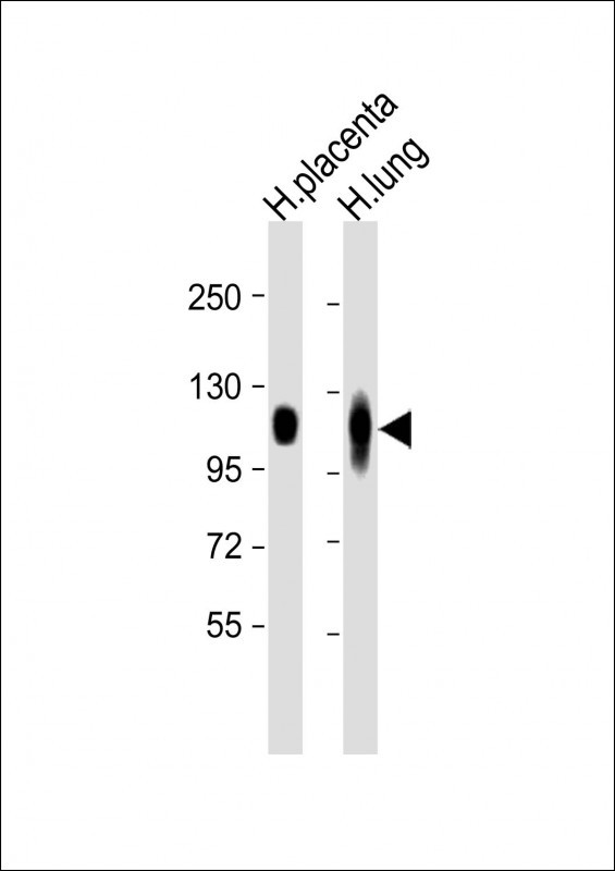 WB - LAMP2 Antibody [Knockout Validated] AW5702-U100