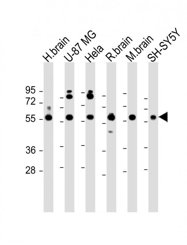 All lanes : Anti-GDI1 Antibody (C-term) at 1:2000 dilutionLane 1: human brain lysateLane 2: U-87 MG whole cell lysateLane 3: Hela whole cell lysateLane 4: rat brain lysateLane 5: mouse brain lysateLane 6: SH-SY5Y whole cell lysateLysates/proteins at 20 �g per lane. SecondaryGoat Anti-Rabbit IgG,  (H+L), Peroxidase conjugated at 1/10000 dilution. Predicted band size : 51 kDaBlocking/Dilution buffer: 5% NFDM/TBST.