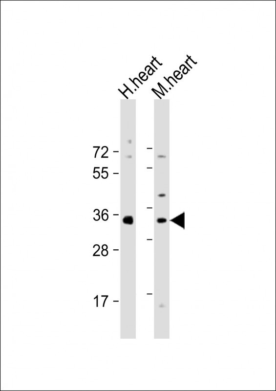 All lanes : Anti-Mouse Nkx2-5 Antibody (Center) at 1:2000 dilutionLane 1: human heart lysateLane 2: mouse heart lysateLysates/proteins at 20 �g per lane. SecondaryGoat Anti-Rabbit IgG,  (H+L), Peroxidase conjugated at 1/10000 dilution. Predicted band size : 34 kDaBlocking/Dilution buffer: 5% NFDM/TBST.