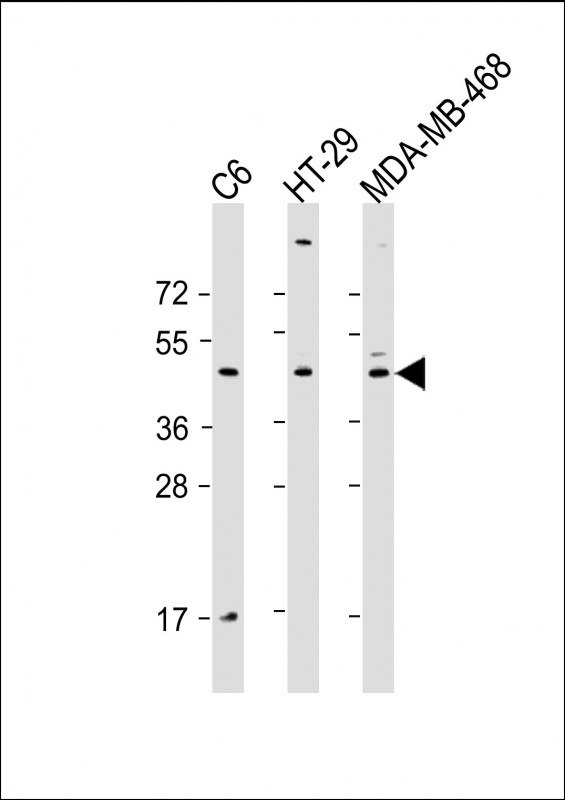 All lanes : Anti-GSK3BAntibody at 1:2000 dilutionLane 1: C6 whole cell lysateLane 2: HT-29 whole cell lysateLane 3: MDA-MB-468 whole cell lysateLysates/proteins at 20 �g per lane. SecondaryGoat Anti-Rabbit IgG,  (H+L), Peroxidase conjugated at 1/10000 dilution. Predicted band size : 47 kDaBlocking/Dilution buffer: 5% NFDM/TBST.