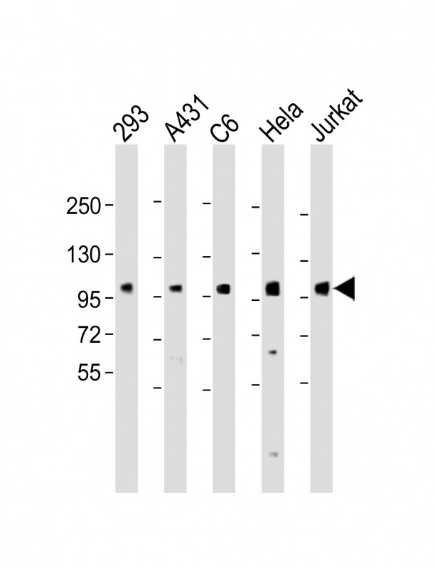 All lanes : Anti-EEF2k Antibody at 1:2000 dilutionLane 1: 293 whole cell lysateLane 2: A431 whole cell lysateLane 3: C6 whole cell lysateLane 4: Hela whole cell lysateLane 5: Jurkat whole cell lysateLysates/proteins at 20 �g per lane.  SecondaryGoat Anti-Rabbit IgG,   (H+L),  Peroxidase conjugated at 1/10000 dilution.  Predicted band size : 82 kDaBlocking/Dilution buffer: 5% NFDM/TBST.