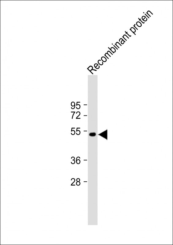 WB - TrpE Antibody AP22229a