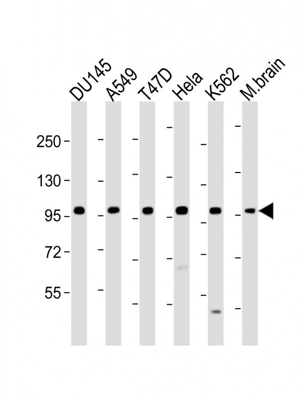 WB - FGFR2 Antibody (N-term) AP7637a