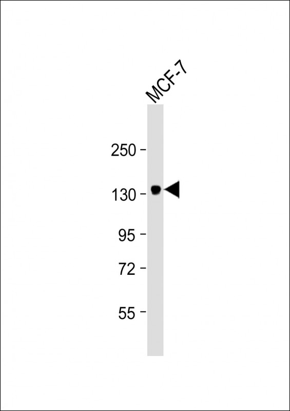 Anti-ABCB4 Antibody at 1:4000 dilution + MCF-7 whole cell lysateLysates/proteins at 20 �g per lane. SecondaryGoat Anti-mouse IgG,  (H+L), Peroxidase conjugated at 1/10000 dilution. Predicted band size : 142 kDaBlocking/Dilution buffer: 5% NFDM/TBST.