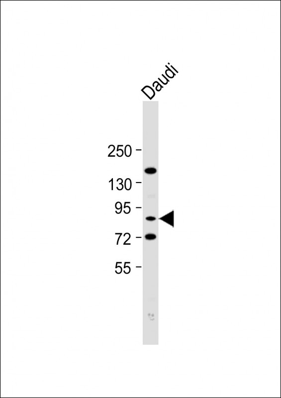 WB - SCNN1A Antibody (Center) AP8804C