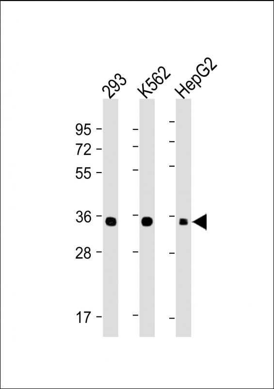 WB - LIN28B Antibody [Knockout Validated] AW5710-U100