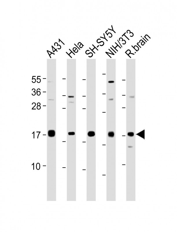 All lanes : Anti-hCalmodulin-D132 at 1:2000 dilutionLane 1: A431 whole cell lysateLane 2: Hela whole cell lysateLane 3: SH-SY5Y whole cell lysateLane 4: NIH/3T3 whole cell lysateLane 5: Rat brain lysateLysates/proteins at 20 �g per lane. SecondaryGoat Anti-Rabbit IgG,  (H+L), Peroxidase conjugated at 1/10000 dilution. Predicted band size : 17 kDaBlocking/Dilution buffer: 5% NFDM/TBST.