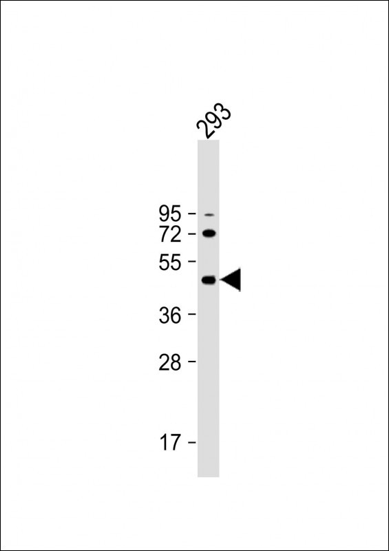 WB - ALKBH5 Antibody (Center) AP18410c