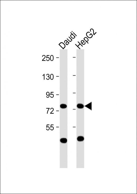 WB - MPL Antibody (N-Term) AP22241a