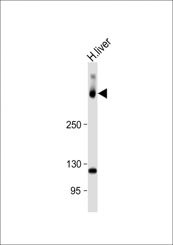 Anti-SYNE2 Antibody (N-Term) at 1:1000 dilution + Human liver lysateLysates/proteins at 20 �g per lane. SecondaryGoat Anti-Rabbit IgG,  (H+L), Peroxidase conjugated at 1/10000 dilution. Predicted band size : 796 kDaBlocking/Dilution buffer: 5% NFDM/TBST.
