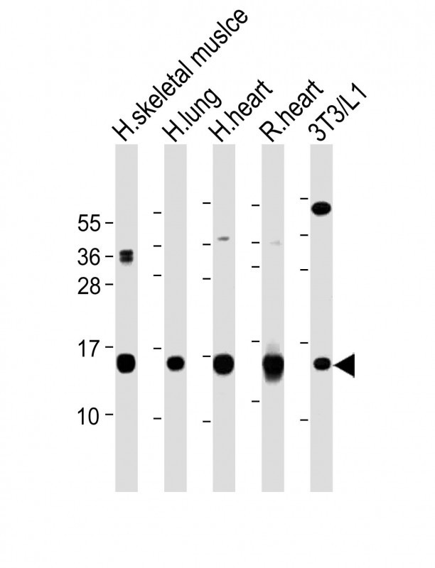 All lanes : Anti-FABP4 Antibody (Y20) at 1:2000-1:8000 dilutionLane 1: Human skeletal muslce lysateLane 2: Human lung lysateLane 3: Human heart lysateLane 4: Rat heart lysateLane 5: 3T3/L1 whole cell lysateLysates/proteins at 20 �g per lane. SecondaryGoat Anti-Rabbit IgG,  (H+L), Peroxidase conjugated at 1/10000 dilution. Predicted band size : 15 kDaBlocking/Dilution buffer: 5% NFDM/TBST.