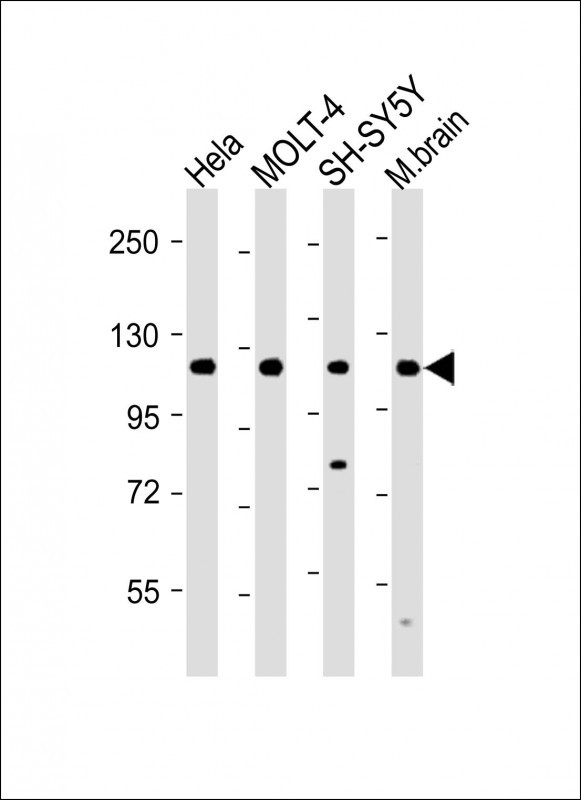 WB - KIAA1688 Antibody (C-term) AP5966b