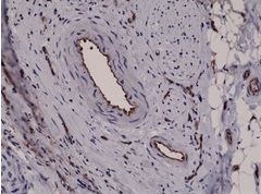 IHC - Anti- CD31 (PECAM-1) Rabbit Monoclonal Antibody  ABV11817-50