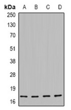 WB - Phospho-HSP20 (Ser16) Antibody ABV11847-100