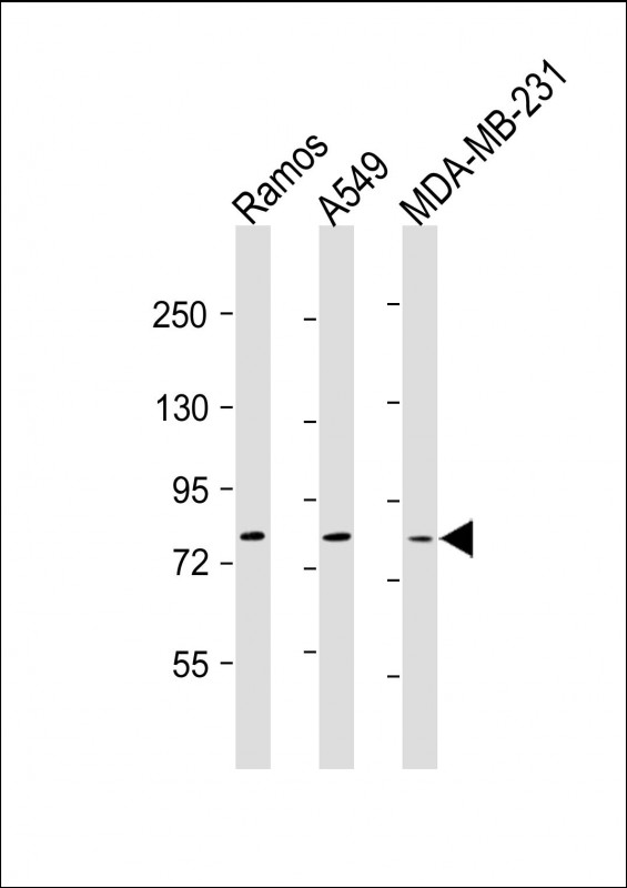 All lanes : Anti-TLR2 Antibody at 1:500-1:1000 dilutionLane 1: Ramos whole cell lysateLane 2: A549 whole cell lysateLane 3: MDA-MB-231 whole cell lysateLysates/proteins at 20 �g per lane. SecondaryGoat Anti-mouse IgG,  (H+L), Peroxidase conjugated at 1/10000 dilution. Predicted band size : 85 kDaBlocking/Dilution buffer: 5% NFDM/TBST.