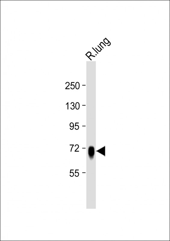 Anti-ST7 Antibody (Center) at 1:8000 dilution + Rat lung lysateLysates/proteins at 20 �g per lane. SecondaryGoat Anti-Rabbit IgG,  (H+L), Peroxidase conjugated at 1/10000 dilution. Predicted band size : 67 kDaBlocking/Dilution buffer: 5% NFDM/TBST.