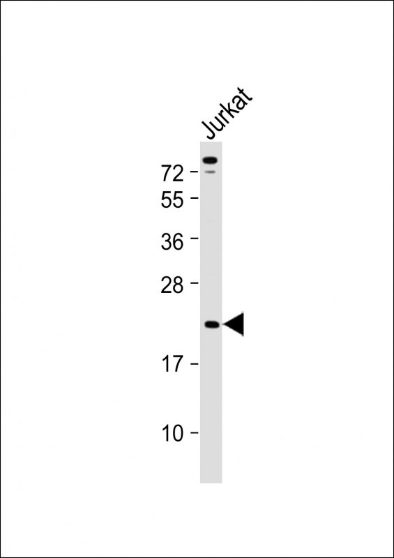 Anti-TCRB Antibody (Center) at 1:2000 dilution + Jurkat whole cell lysateLysates/proteins at 20 �g per lane. SecondaryGoat Anti-Rabbit IgG,  (H+L), Peroxidase conjugated at 1/10000 dilution. Predicted band size : 15 kDaBlocking/Dilution buffer: 5% NFDM/TBST.