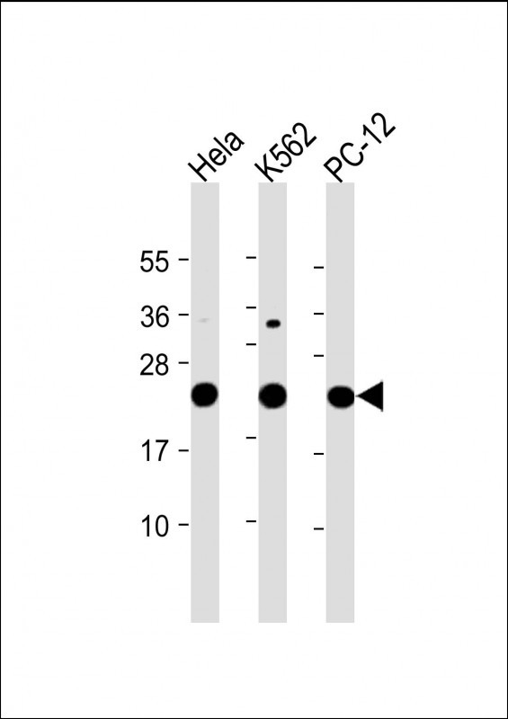 WB - LZIC Antibody (Center) AP17735c