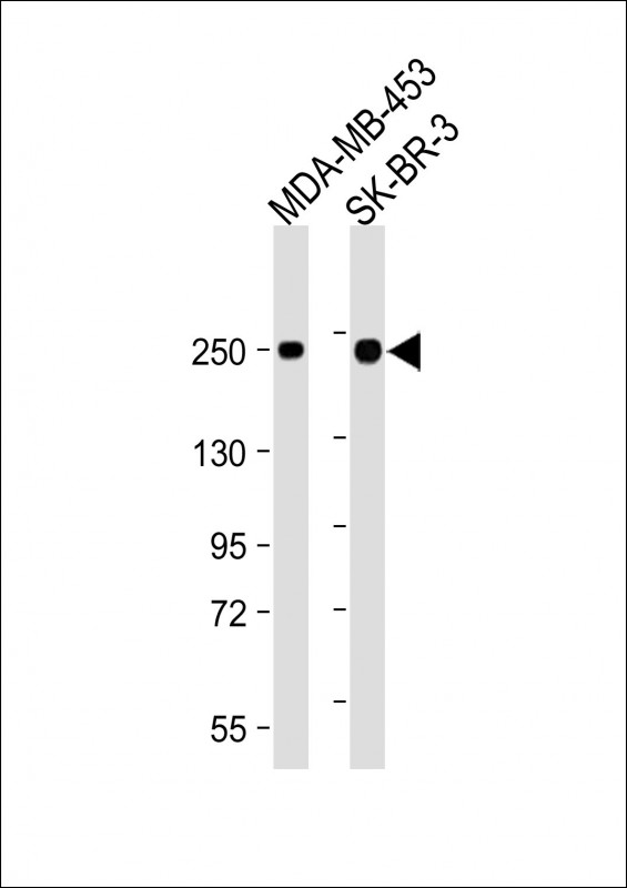 All lanes : Anti-ERBB2-T1172/S1174 at 1:2000 dilutionLane 1: MDA-MB-453 whole cell lysateLane 2: SK-BR-3 whole cell lysateLysates/proteins at 20 �g per lane. SecondaryGoat Anti-Rabbit IgG,  (H+L), Peroxidase conjugated at 1/10000 dilution. Predicted band size : 138 kDaBlocking/Dilution buffer: 5% NFDM/TBST.