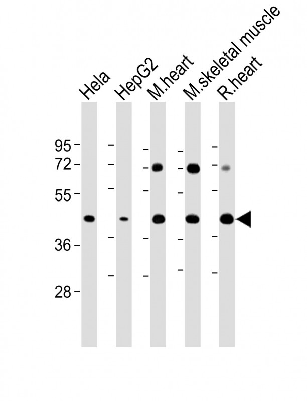 All lanes : Anti-GYG1 Antibody (C-Term) at 1:2000 dilutionLane 1: Hela whole cell lysateLane 2: HepG2 whole cell lysateLane 3: Mouse heart lysateLane 4: Mouse skeletal muscle lysateLane 5: Rat heart lysateLysates/proteins at 20 �g per lane. SecondaryGoat Anti-Rabbit IgG,  (H+L), Peroxidase conjugated at 1/10000 dilution. Predicted band size : 39 kDaBlocking/Dilution buffer: 5% NFDM/TBST.