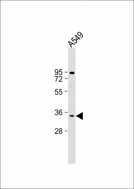Anti-MAGEA2 Antibody (N-term) at 1:2000 dilution + A549 whole cell lysateLysates/proteins at 20 �g per lane.  SecondaryGoat Anti-Rabbit IgG,   (H+L),  Peroxidase conjugated at 1/10000 dilution.  Predicted band size : 35 kDaBlocking/Dilution buffer: 5% NFDM/TBST.