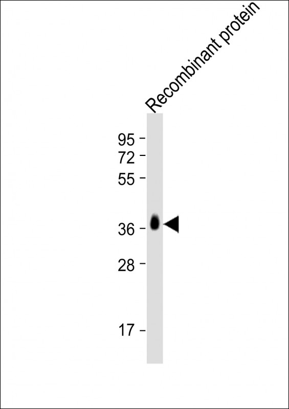 Anti-BRCA2 antibody at 1:2000 dilution + Recombinant proteinLysates/proteins at 20ng per lane. SecondaryGoat Anti-mouse IgG,  (H+L), Peroxidase conjugated at 1/10000 dilution. Predicted band size : 384 kDaBlocking/Dilution buffer: 5% NFDM/TBST.