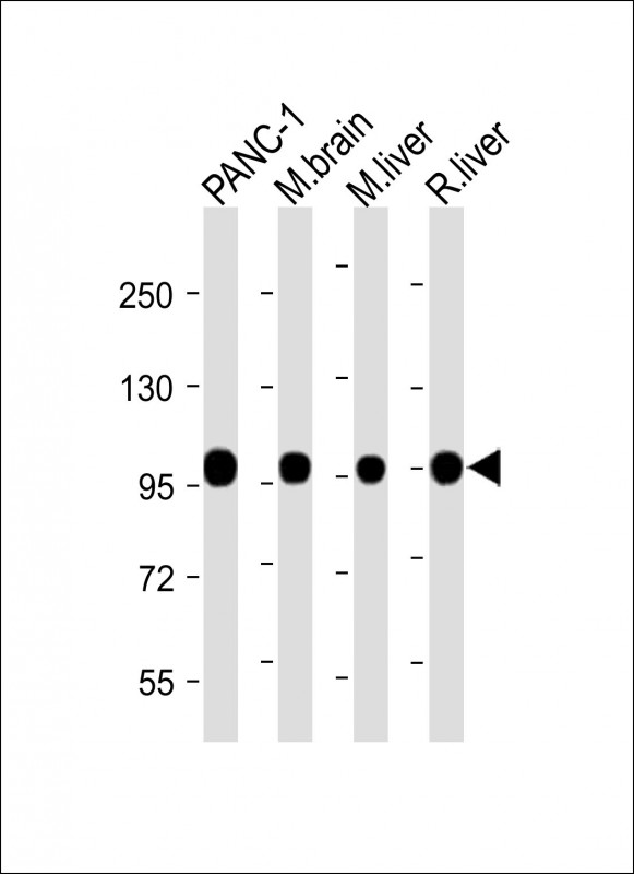 All lanes : Anti-CANX Antibody (C-Term) at 1:2000 dilutionLane 1: PANC-1 lysateLane 2: Mouse brain lysateLane 3: Mouse liver lysateLane 4: Rat liver lysateLysates/proteins at 20 �g per lane. SecondaryGoat Anti-Rabbit IgG,  (H+L), Peroxidase conjugated at 1/10000 dilution. Predicted band size : 68 kDaBlocking/Dilution buffer: 5% NFDM/TBST.