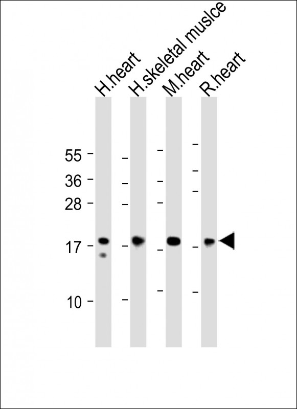 All lanes : Anti-MYL2 Antibody (Center) at 1:2000 dilutionLane 1: Human heart lysateLane 2: Human skeletal muslce lysateLane 3: Mouse heart lysateLane 4: Rat heart lysateLysates/proteins at 20 �g per lane. SecondaryGoat Anti-Rabbit IgG,  (H+L), Peroxidase conjugated at 1/10000 dilution. Predicted band size : 19 kDaBlocking/Dilution buffer: 5% NFDM/TBST.