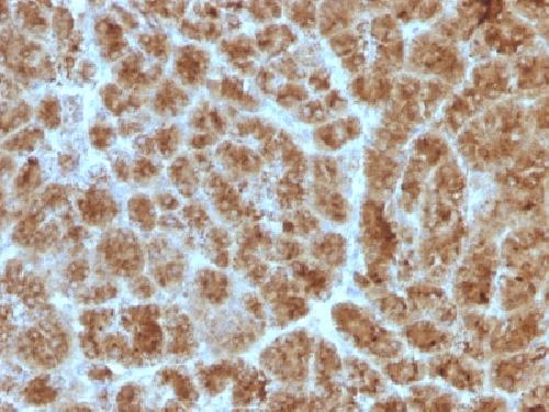 IHC-P - Anti-CELA3B / ELA3B Antibody AH13237-20