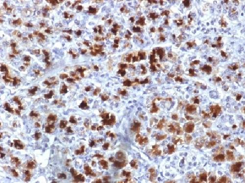 IHC-P - Anti-CELA3B / ELA3B Antibody AH13241-20