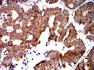 IHC - Mouse Monoclonal Antibody to PTPN14 AO2382a