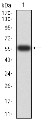 WB - Mouse Monoclonal Antibody to PTPN14 AO2382a