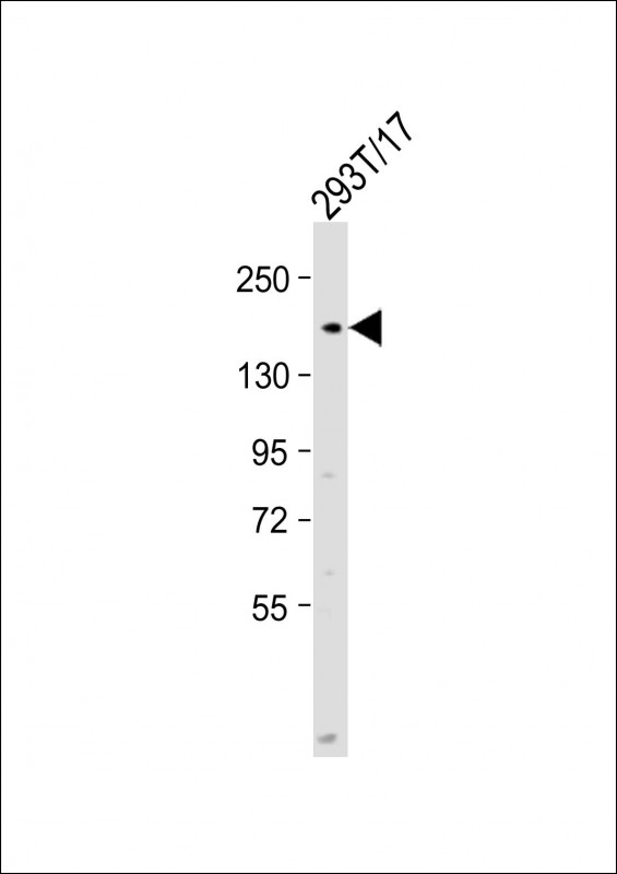 Anti-POLA1 Antibody (N-Term) at 1:2000 dilution + 293T/17 whole cell lysateLysates/proteins at 20 �g per lane. SecondaryGoat Anti-Rabbit IgG,  (H+L), Peroxidase conjugated at 1/10000 dilution. Predicted band size : 166 kDaBlocking/Dilution buffer: 5% NFDM/TBST.