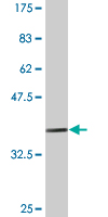 WB - PDE4C monoclonal antibody (M03A), clone 6A10 AT4667a