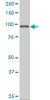 WB - PDE4C monoclonal antibody (M03A), clone 6A10 AT4667a