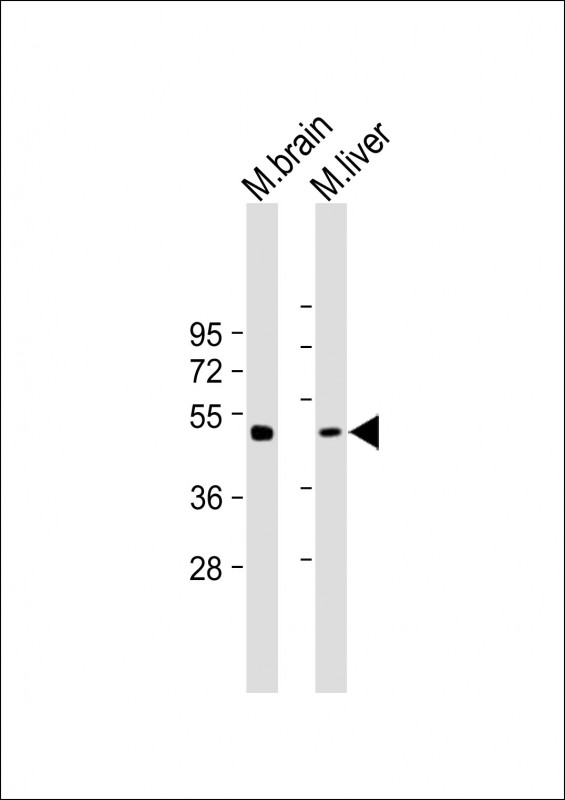 WB - gamma Tubulin Antibody AP22339a