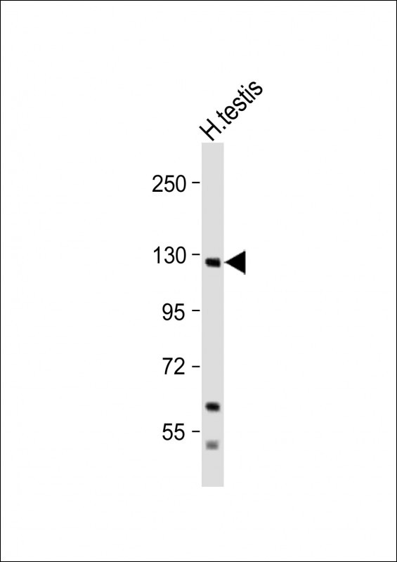 Anti-RAT) Epha6 Antibody at 1:2000 dilution + Human testis cell lysateLysates/proteins at 20 �g per lane. SecondaryGoat Anti-Rabbit IgG,  (H+L), Peroxidase conjugated at 1/10000 dilution. Predicted band size : 116 kDaBlocking/Dilution buffer: 5% NFDM/TBST.