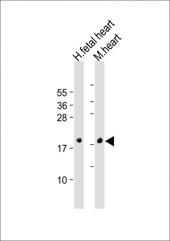 All lanes : Anti-NPPA Antibody (N-term) at 1:2000 dilutionLane 1: Human fetal heart lysateLane 2: Mouse heart lysateLysates/proteins at 20 �g per lane. SecondaryGoat Anti-Rabbit IgG,  (H+L), Peroxidase conjugated at 1/10000 dilution. Predicted band size : 17 kDaBlocking/Dilution buffer: 5% NFDM/TBST.