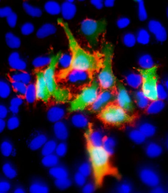 Immunofluorescent analysis of GFP using either natural fluorescence (green) or an GFP antibody (red) in Hela(human cervical epithelial adenocarcinoma cell line) cells transfected with GFP recombinant protein. Formalin-fixed cells were permeabilized with 0. 1% Triton X-100 for 10 minutes at room temperature and blocked with 3% BSA for 30 minutes at room temperature. Cells were probed with an GFP monoclonal antibody (Product # AM1009a) at a dilution of 1:25 for 1 hour at 37C, and incubated with DyLight 555 goat anti-mouse IgG secondary antibody (Product # 1511348) at a dilution of 1:200 for 60 minutes at 37℃. The nuclear counter stain is DAPI (blue).