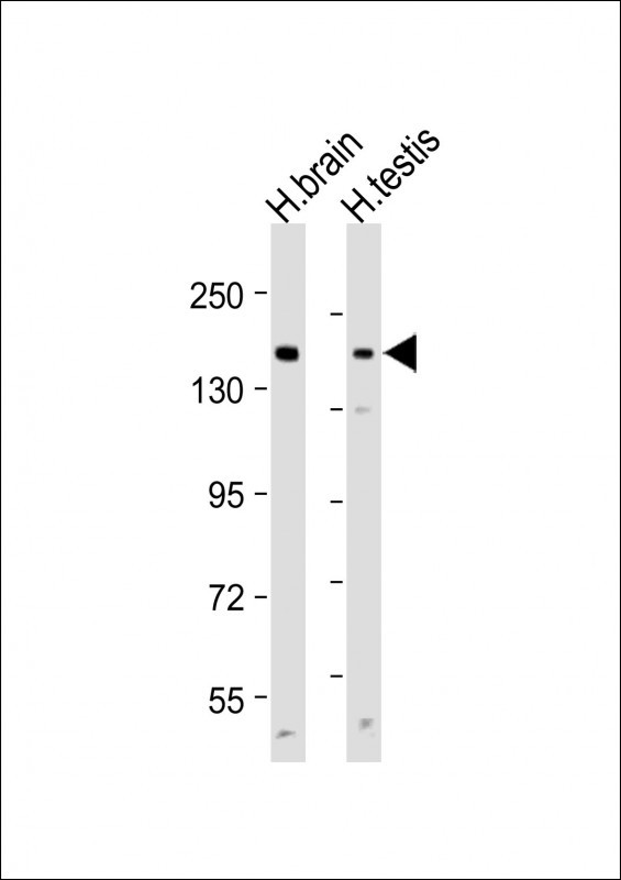 All lanes : Anti-ABCC3 Antibody (Center) at 1:1000 dilutionLane 1: Human brain lysateLane 2: Human testis lysateLysates/proteins at 20 �g per lane. SecondaryGoat Anti-Rabbit IgG,  (H+L), Peroxidase conjugated at 1/10000 dilution. Predicted band size : 169 kDaBlocking/Dilution buffer: 5% NFDM/TBST.